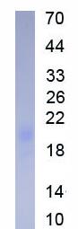 Active Allograft inflammatory factor 1 (AIF1)