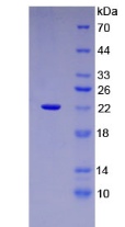 Active Mesencephalic Astrocyte Derived Neurotrophic Factor (MANF)