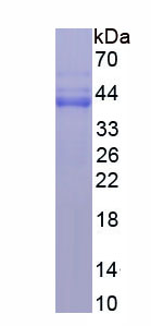 Active Activating Transcription Factor 3 (ATF3)