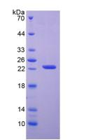 Active Adenine Phosphoribosyltransferase (APRT)