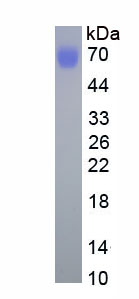 Active Antithrombin (AT)