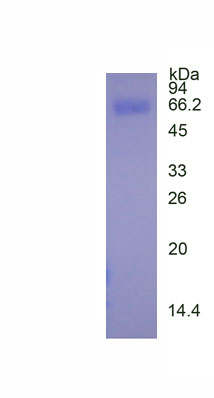 Active Carboxylesterase 1 (CES1)