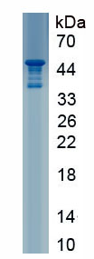 Active Cathelicidin Antimicrobial Peptide (CAMP)