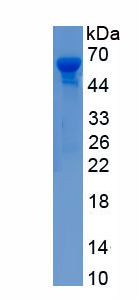 Active Endonuclease G, Mitochondrial (ENDOG)