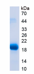 Active Endothelial Cell Specific Molecule 1 (ESM1)