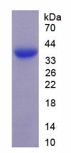 Active Microfibrillar Associated Protein 2 (MFAP2)