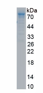 Active Insulin Like Growth Factor Binding Protein 5 (IGFBP5)