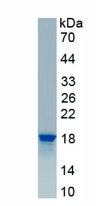 Active Ribophorin I (RPN1)