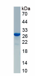 Active Transmembrane Protease, Serine 2 (TMPRSS2)