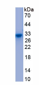 Active Lysyl tRNA Synthetase (KARS)