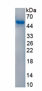 Active Acid Phosphatase 6, Lysophosphatidic (ACP6)