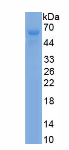 Active Cytochrome P450 3A4 (CYP3A4)