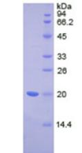 Active Interleukin 17 Receptor D (IL17RD)