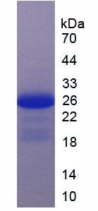 Active Interleukin 17 Receptor C (IL17RC)