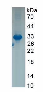 Active Phospholipase A2 Receptor 1 (PLA2R1)