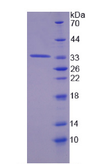 Active Tyrosine Aminotransferase (TAT)