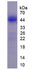 Active Lemur Tyrosine Kinase 3 (LMTK3)