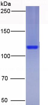 Active Interleukin 23 Receptor (IL23R)