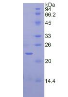 Active Sirtuin 3 (SIRT3)