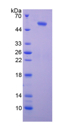 Active Phosphatase And Tensin Homolog (PTEN)