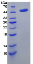 Active Adenosylhomocysteinase (AHCY)