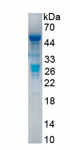 Active Arylsulfatase B (ARSB)