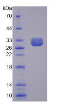 Active Chloride Channel Accessory 1 (CLCA1)