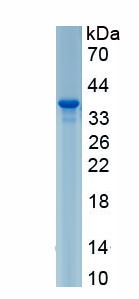 Active TANK Binding Kinase 1 (TBK1)