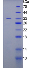 Active Inter Alpha-Globulin Inhibitor H4 (ITIH4)