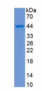 Active NLR Family, Pyrin Domain Containing Protein 3 (NLRP3)