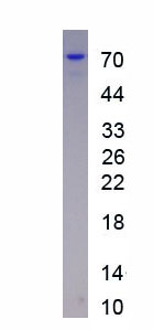 Active A Disintegrin And Metalloprotease 12 (ADAM12)