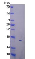 Active Regenerating Islet Derived Protein 3 Beta (REG3b)