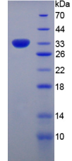 Active Myxovirus Resistance 1 (MX1)