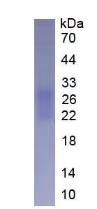 Active Fibronectin Type III Domain Containing Protein 5 (FNDC5)