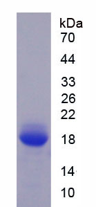 Active Fibronectin Type III Domain Containing Protein 5 (FNDC5)