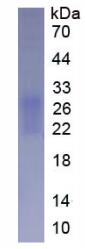 Active Fibronectin Type III Domain Containing Protein 5 (FNDC5)