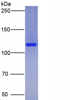 Active Poly ADP Ribose Glycohydrolase (PARG)