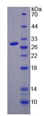 Active Meteorin Like Protein (METRNL)