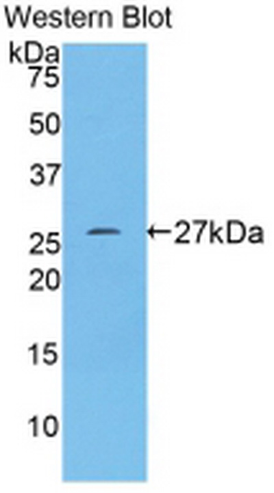 Anti-Transferrin Receptor (TFR) Polyclonal Antibody