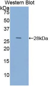 Anti-Actin Alpha 1, Cardiac Muscle (ACTC1) Polyclonal Antibody