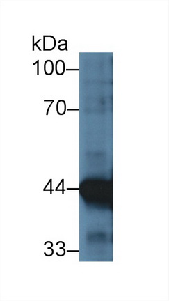 Anti-Actin Alpha 1, Cardiac Muscle (ACTC1) Monoclonal Antibody