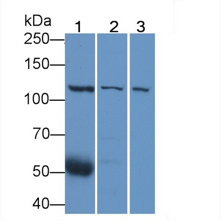 Anti-Vinculin (VCL) Monoclonal Antibody