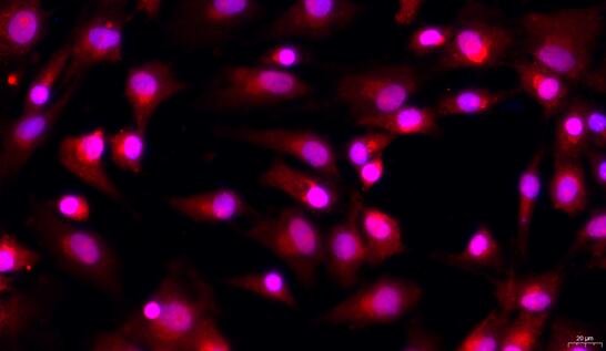 Primary Porcine Articular Chondrocytes (AC)