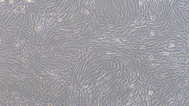 Primary Feline Cardiac Microvascular Endothelial Cells (CMEC)