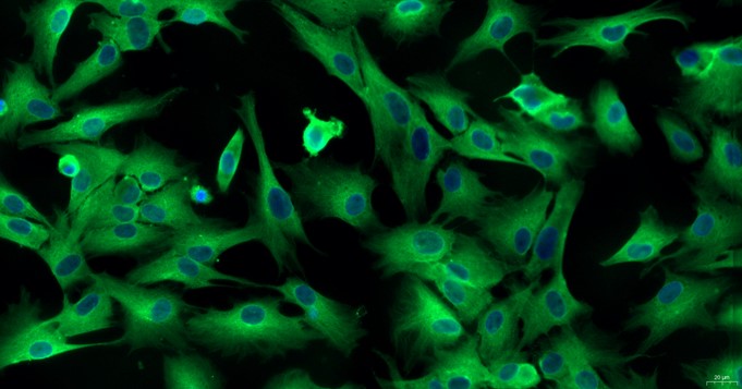 Primary Cavia Annulus Fibrosus Cells (AFC)