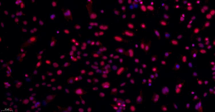 Primary Rabbit Annulus Fibrosus Cells (AFC)