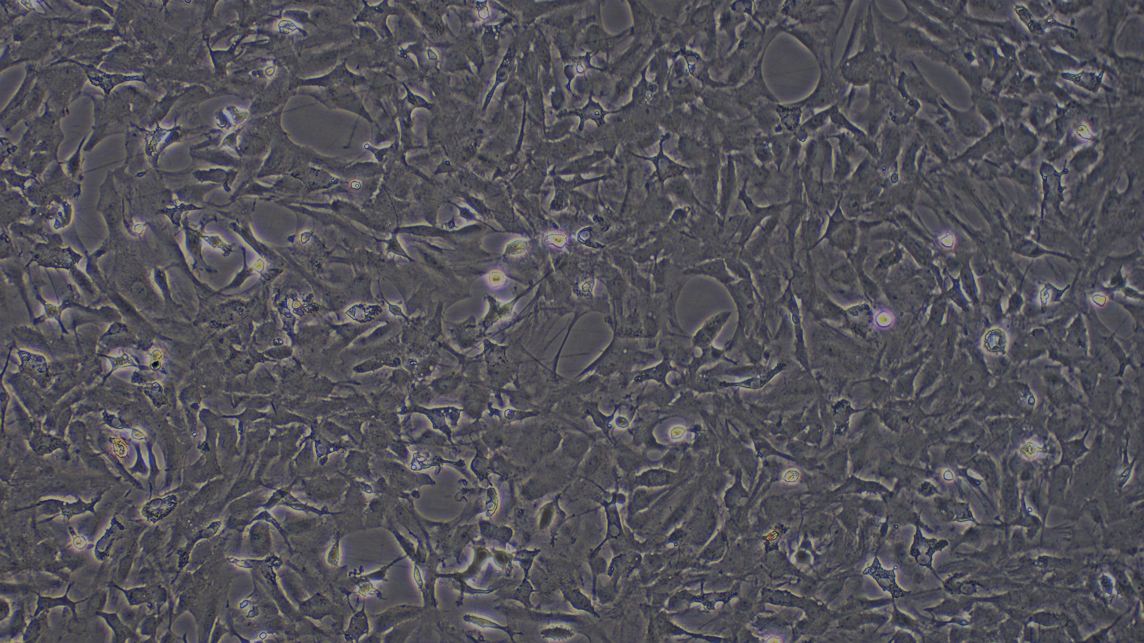 Primary Rat Brain Astrocytes (BA)