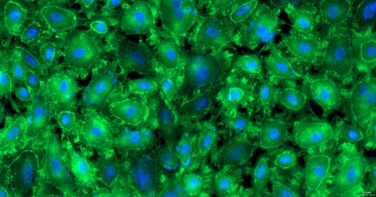 Primary Rabbit Corneal Epithelial Cells (CEC)