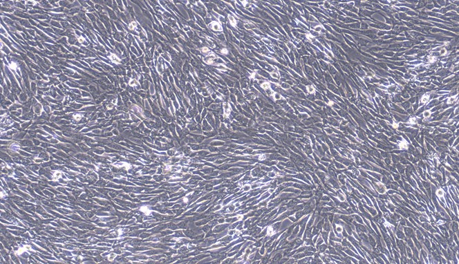 Primary Cavia Subcutaneous Preadipocytes (SPrAD)