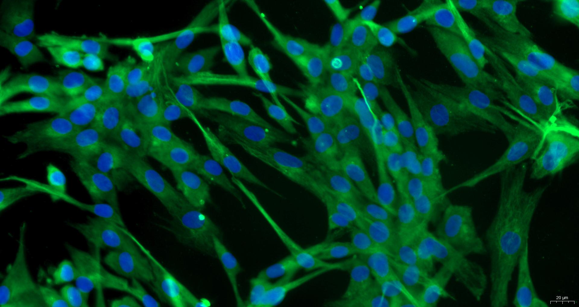 Primary Rat Pulmonary Fibroblasts (PF)